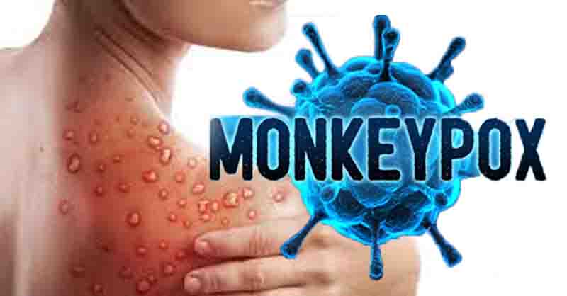 යුරෝපයේ සහ දකුණු ඇමරිකාණු මහද්වීපයේ ‘වඳුරු උණ’ මරණ වාර්තා වෙයි
