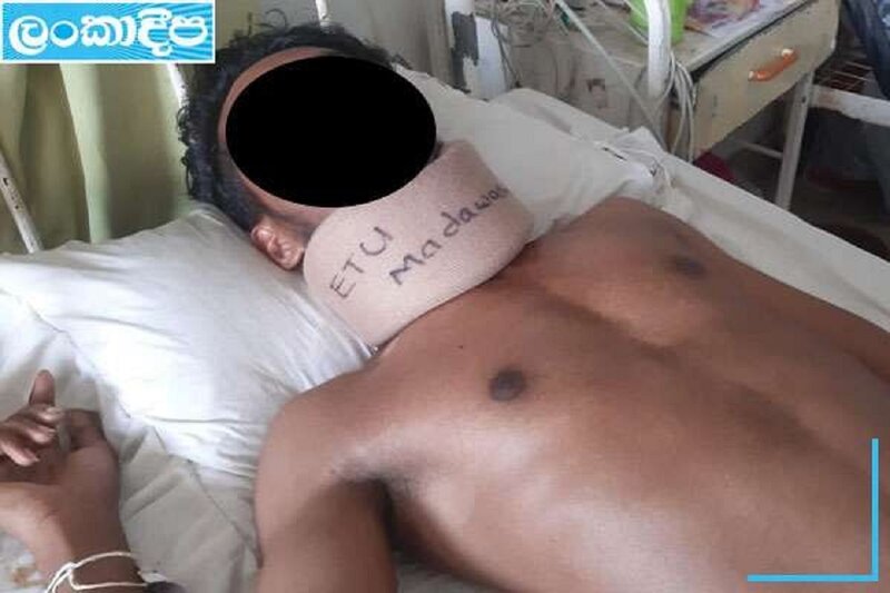 පොලිස් සැරයන්ගේ පුතාට පොලිසියෙන් දරුණු සැත්කමක් කරලා