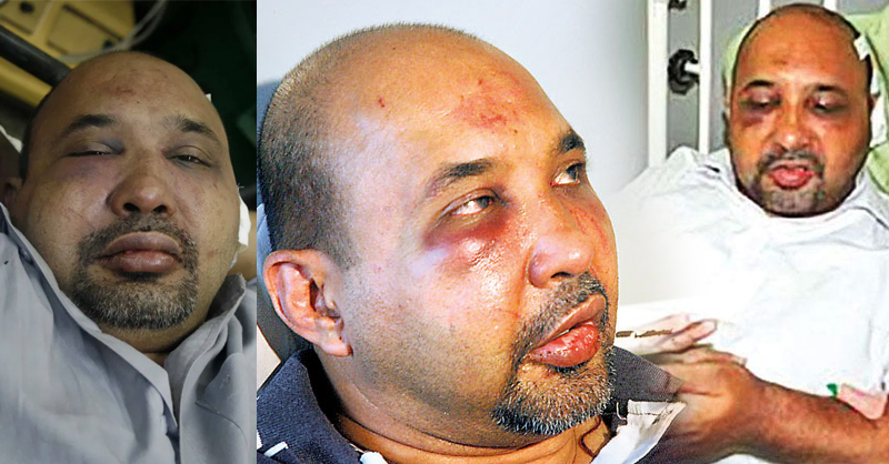 කීත් නොයාර්ට පහරදීම: දෙදෙනෙක් අත්අඩංගුවට